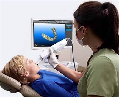 Discover the Itero Demo: Explore the Latest Technology Innovations